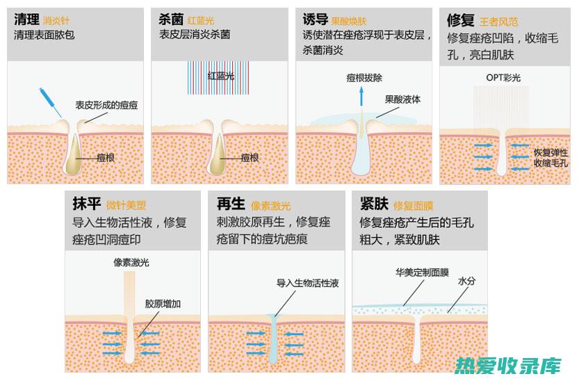 痤疮(痤疮怎么治才能彻底根除)