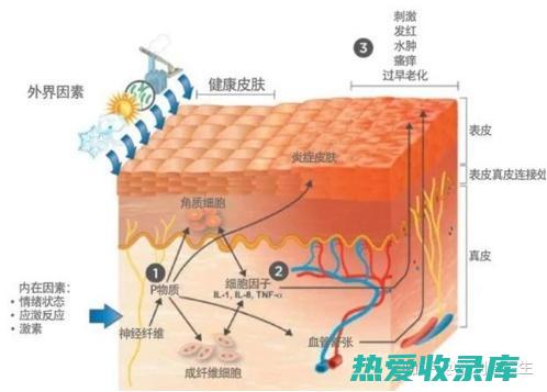 皮肤炎症：金钟中的黄酮类化合物和三萜类化合物具有抗炎作用，可以缓解湿疹、皮炎等皮肤炎症。(皮肤炎症什么药)