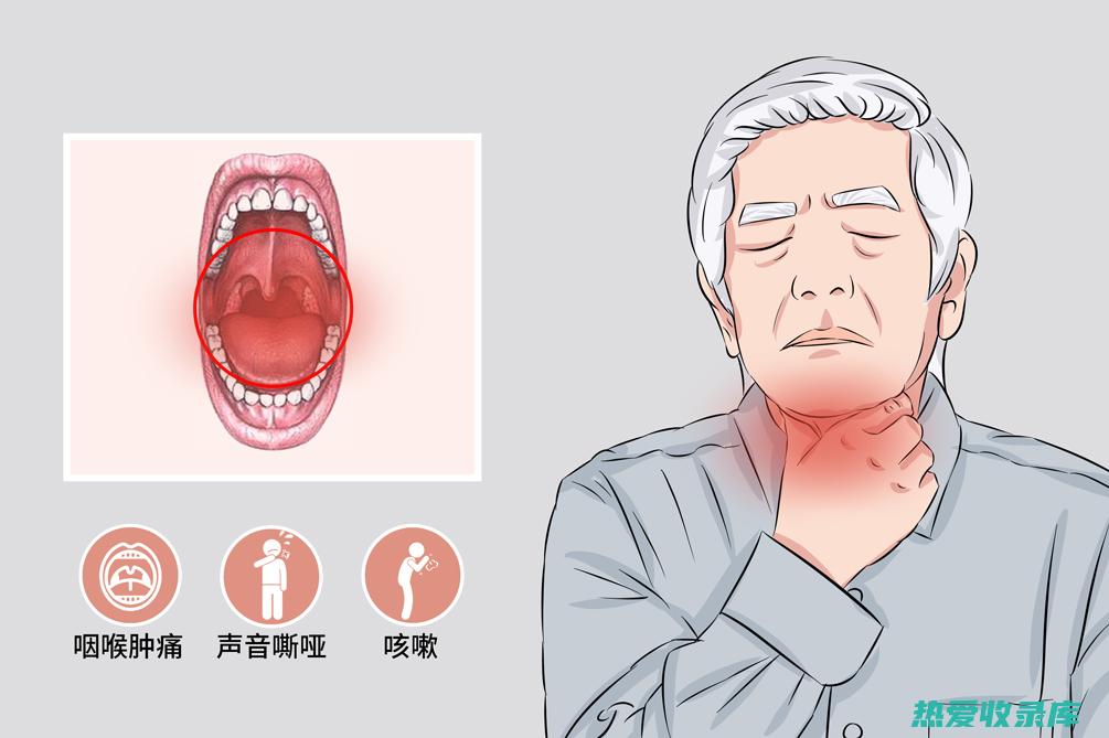 咽喉炎中药处方的五种选择