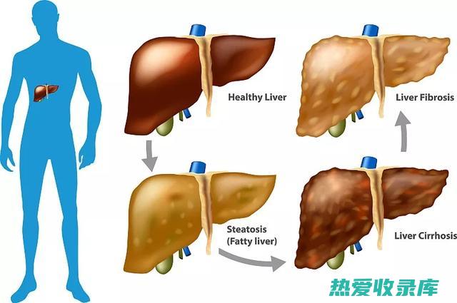 治疗肝脏疾病的中药方 (治疗肝脏疾病的药物)