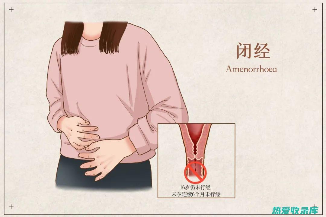 痛经、闭经：山楂山药丸可用于治疗痛经和闭经，可缓解经痛，促进月经排出。(痛经闭经怎么办)