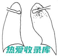 肺结核(肺结核会传染吗)