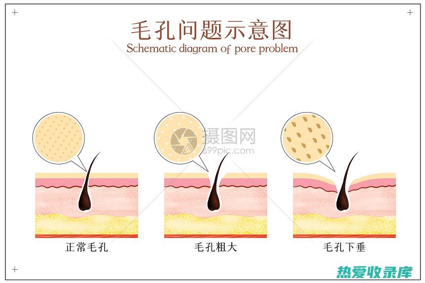 疏通毛孔 (疏通毛孔堵塞最有效的方法)