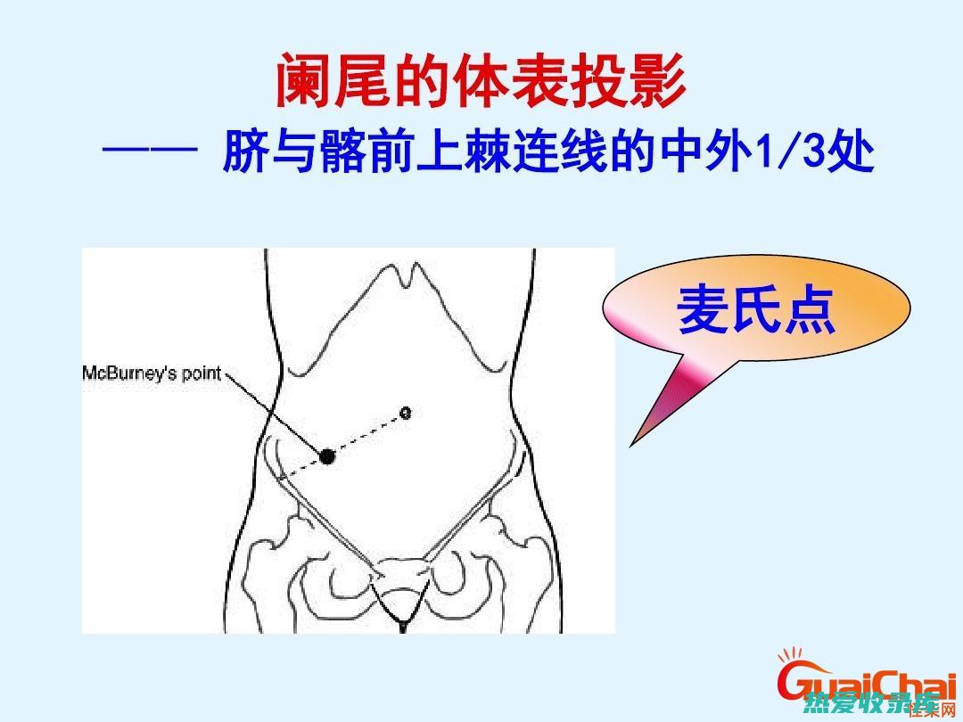 有效的阑尾炎中药治疗 (有效的阑尾炎检查方法)