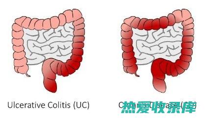 口腔溃疡：乌梅能清热解毒，杀菌消炎，促进口腔溃疡愈合。(口腔溃疡多久能自动愈合)