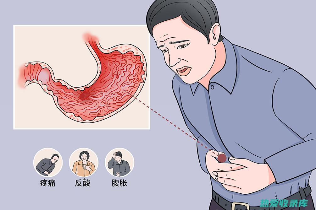 治疗胃溃疡和十二指肠溃疡的药