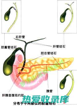 胆的中药治疗