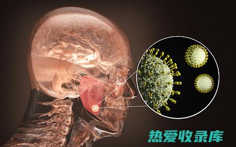 急性腮腺炎的中药治疗 (急性腮腺炎的症状)