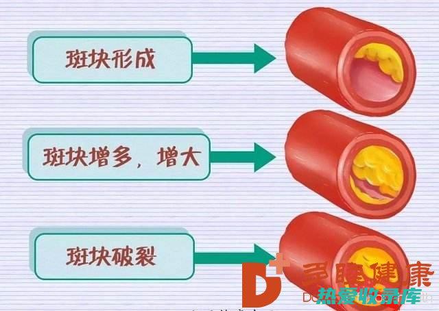 降低胆固醇最好的食物