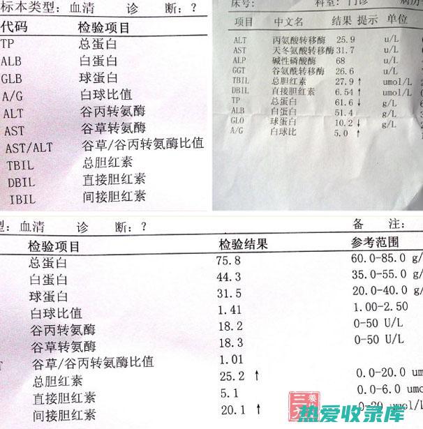 严重肝肾功能不全者慎用。(严重肝肾功能不全者禁用)