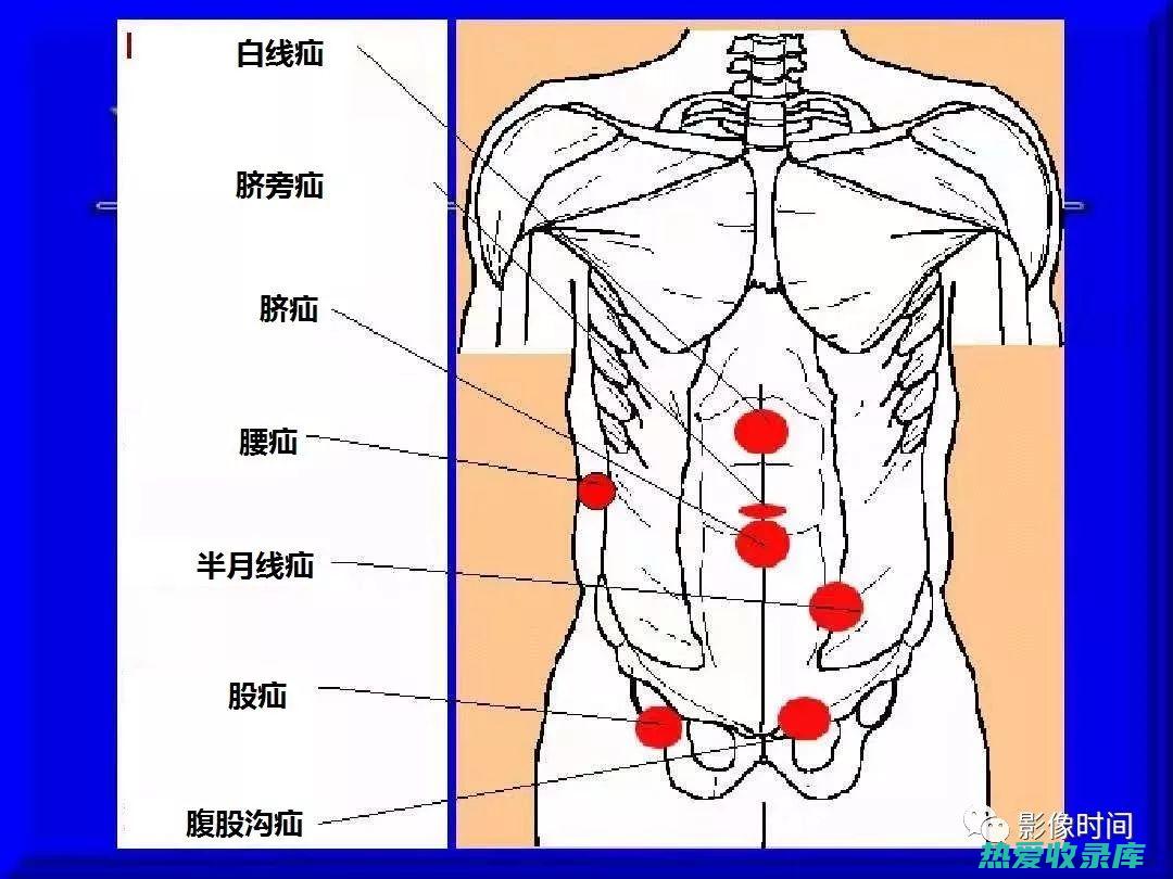 按压腹股沟区域以寻找疼痛或肿胀(按压腹股沟区图片)