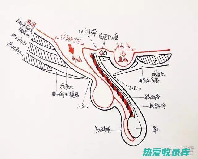 检查腹股沟是否有疝气(检查腹股沟是做CT还比超)