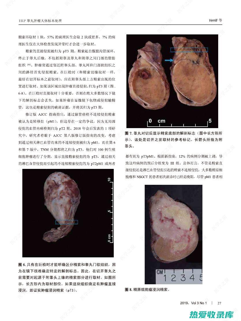 检查睾丸是否有压痛或