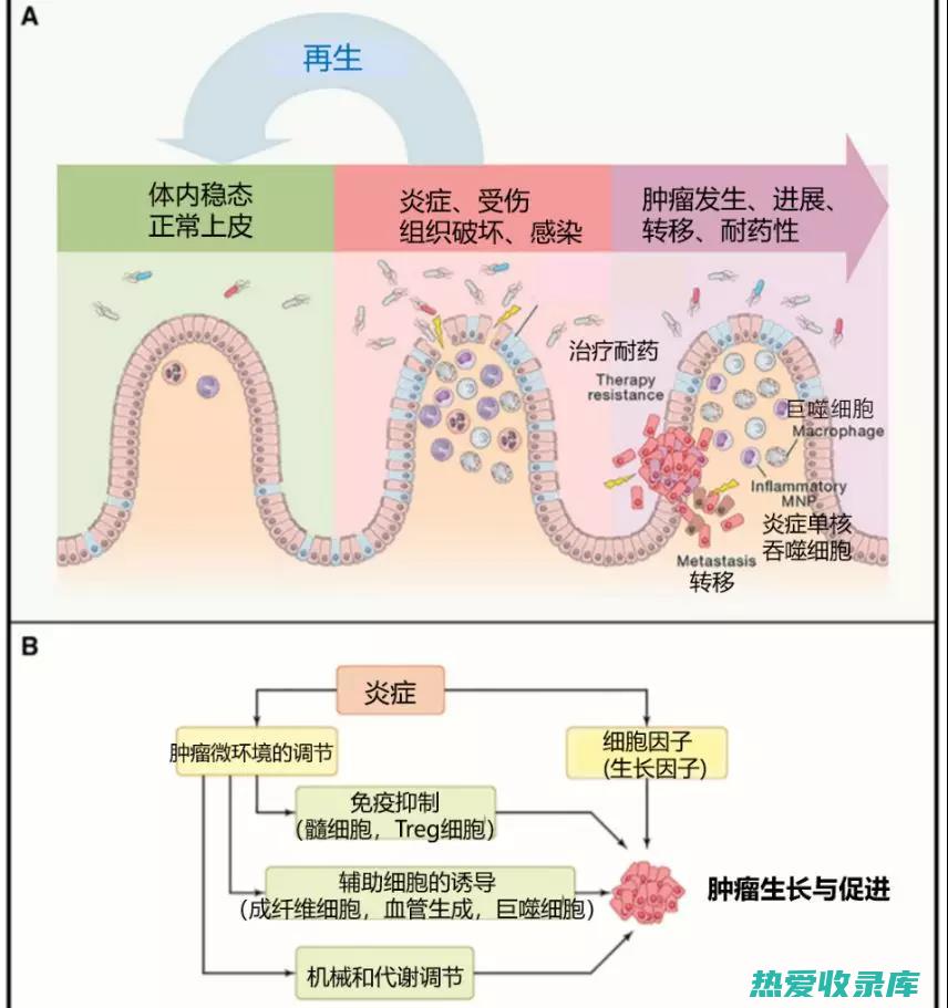 抗炎活性：地黄牛蜘蛛提取物可以抑制炎症反应，减轻炎症症状。(抗炎活性是什么意思)