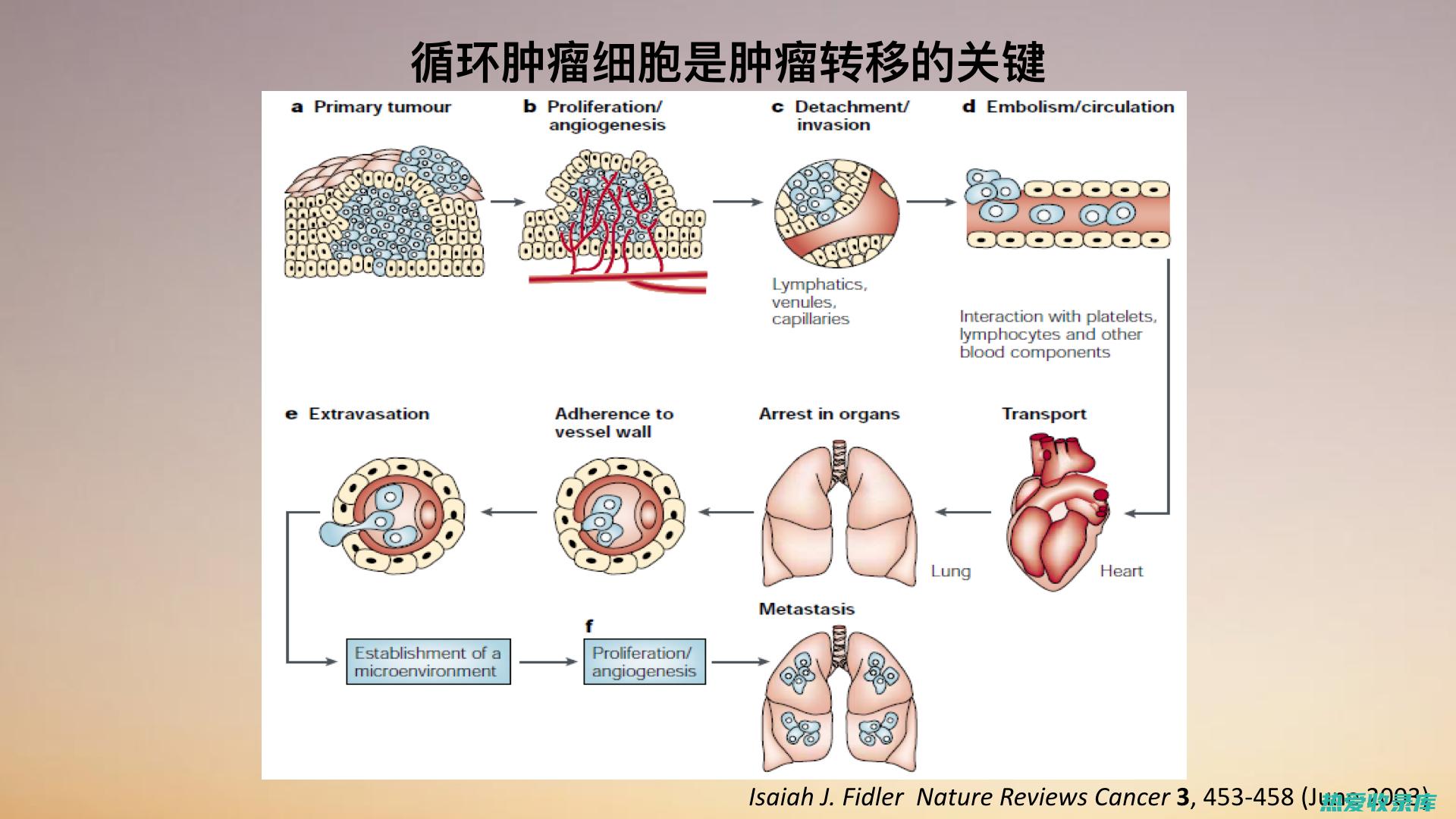 癌症的阶段和类型(癌症的阶段和表现)