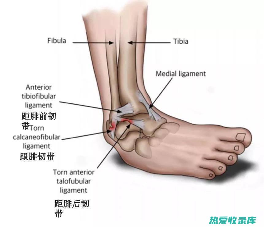 扭伤足部的中药泡脚方剂 (足扭伤中医叫什么名)