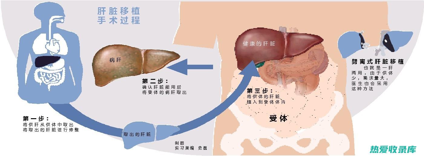 肝功能受损者(肝功能受损者全身发黄能恢复吗)