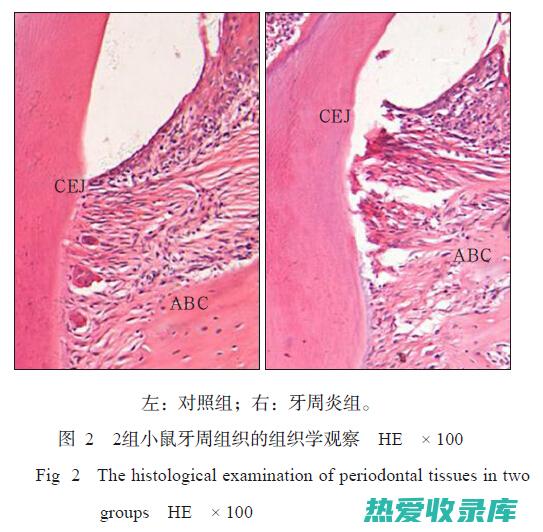 抑制淋巴细胞的活性：淋巴细胞是免疫系统中的白细胞，负责识别和攻击外来病原体。(抑制淋巴细胞偏低)