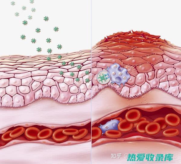 抗炎作用：药蜜具有抗炎作用，可以帮助减轻炎症和疼痛。(抗炎作用药物)