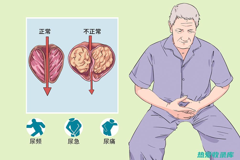 精选前列腺中药方：传统疗法应对男性常见疾病 (精选前列腺中药配方)