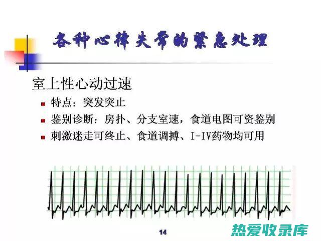 抗心律失常作用：丹参可抑制心律失常，维持正常的窦性心律。(抗心律的药物有哪些)