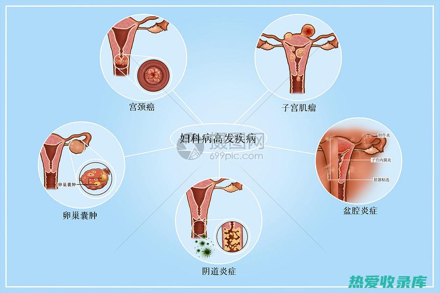 妇科疾病：九龙根的活血化瘀和消炎止痛作用可以治疗妇科疾病，如月经不调、痛经、附件炎等。(妇科九大病种是哪些)