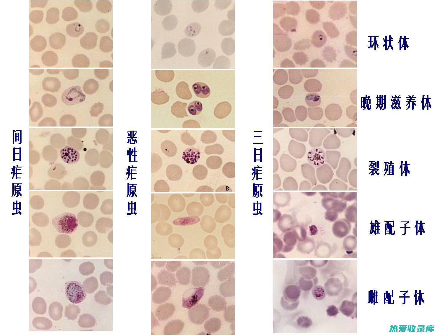 寄生虫感染(寄生虫感染症状)