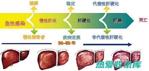 肝炎、肝硬化、脂肪肝(肝炎肝硬化怎么检查出来)