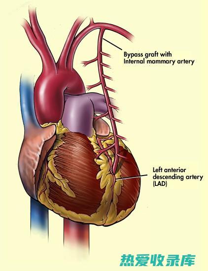 心绞痛等心血管疾病