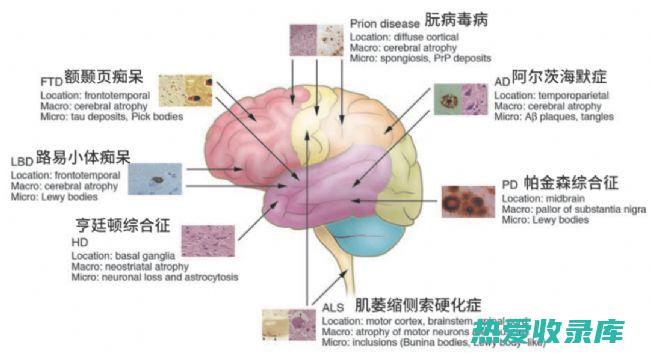 缓解烦躁不安