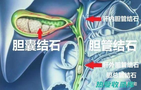 患者不建议