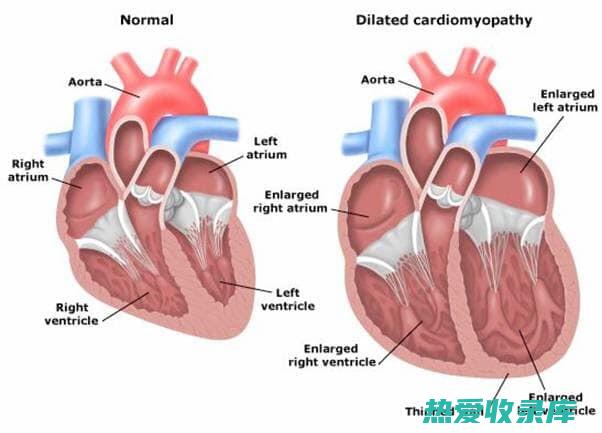 心脏病(心脏病吃啥药)