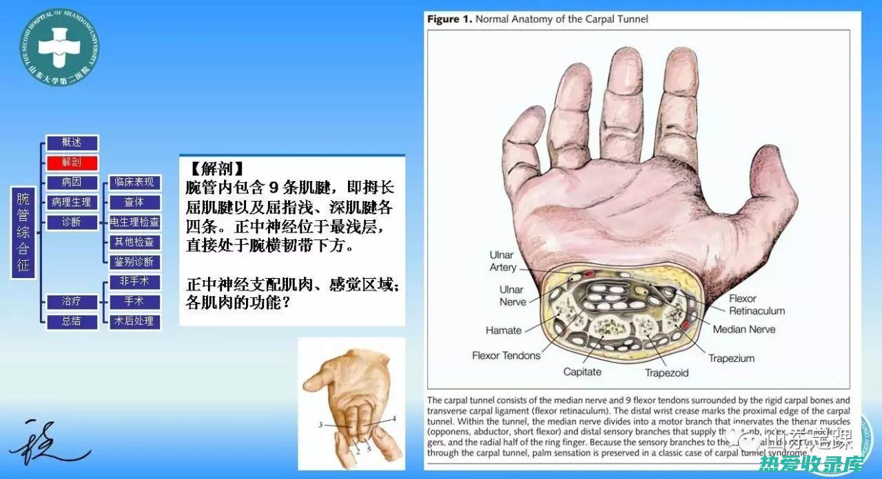 中药治疗腕管综合征：缓解疼痛、改善功能的传统疗法 (中药治疗腕管综合征)