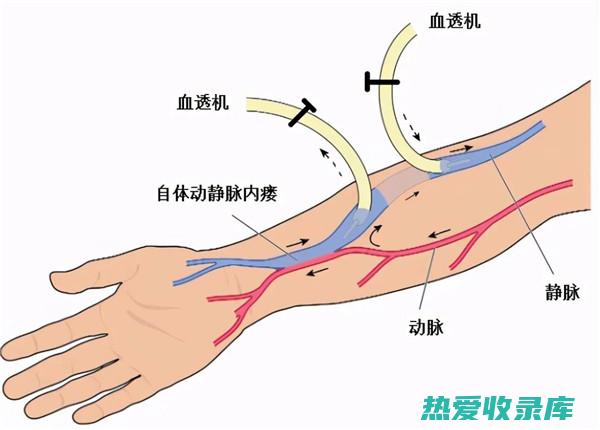 扩张血管：分心木可以扩张冠状动脉和外周血管，改善血流，降低血压，缓解心绞痛和心肌梗塞。(扩张的血管)