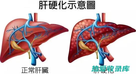 保肝：丹参可以保护肝脏免受损伤，促进肝细胞再生。(丹参可以保肝吗)