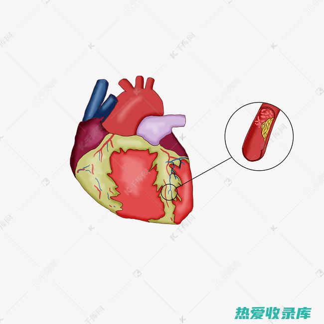 心血管疾病：冠心病、心绞痛、高血压、高血脂(b心血管动脉夹层手术多少钱)