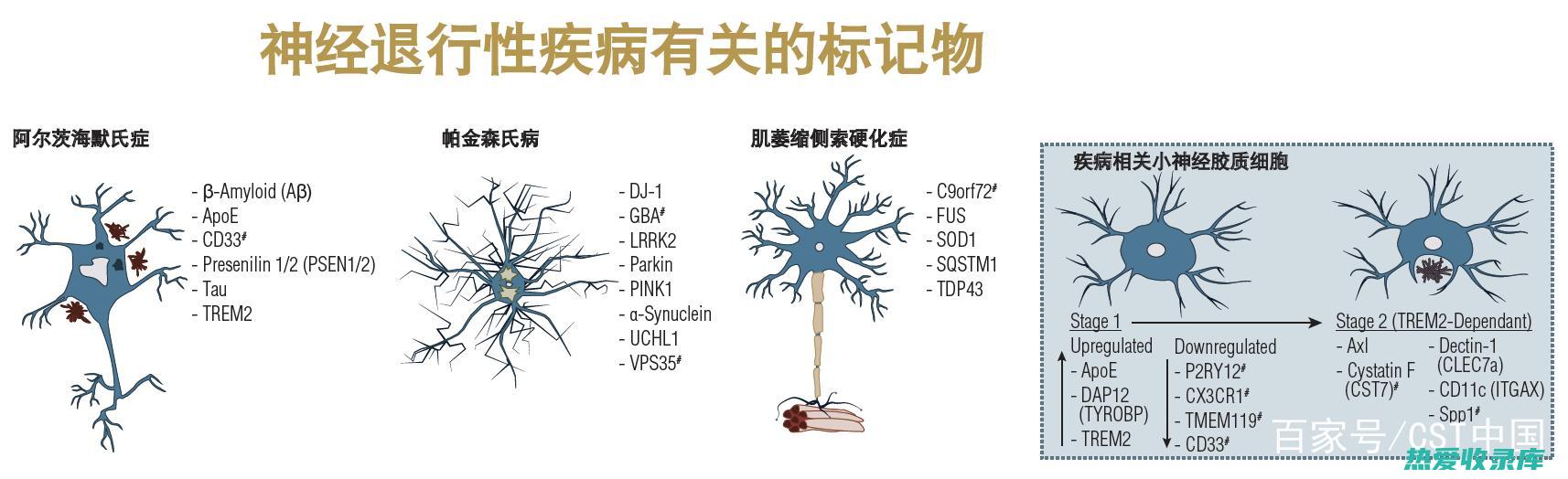 神经系统疾病：阿尔茨海默病、帕金森病(神经系是什么意思)