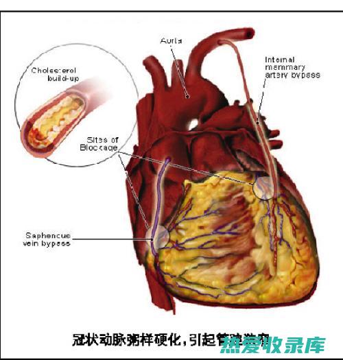 冠状动脉