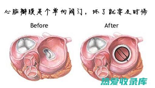 心脏瓣膜疾病：心脏瓣膜出现问题，导致血液流动受阻。(心脏瓣膜疾病包括哪些)