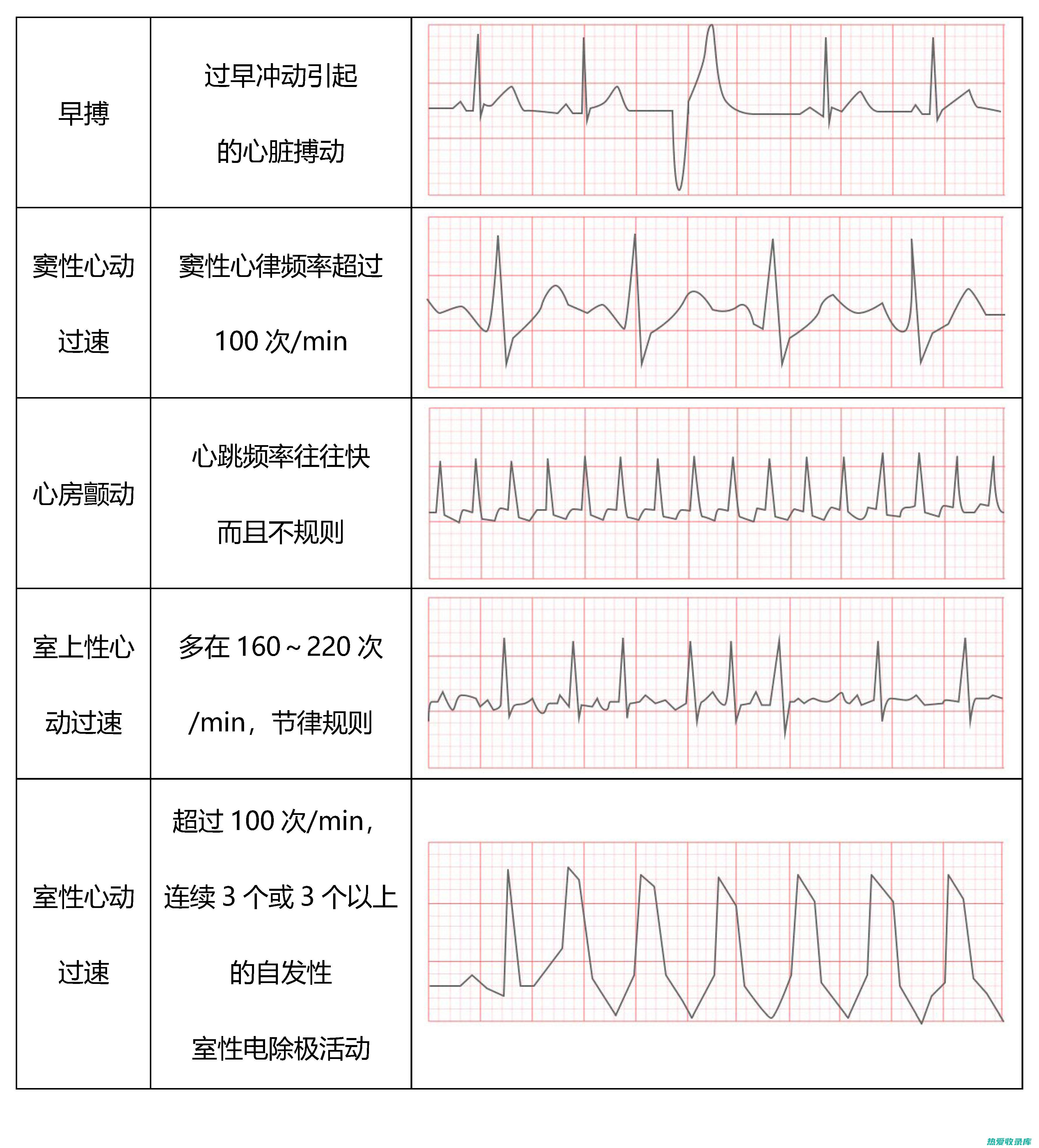 心律失常：心脏跳动异常，导致心率过快或过慢。(心律失常心电图能查出来吗)