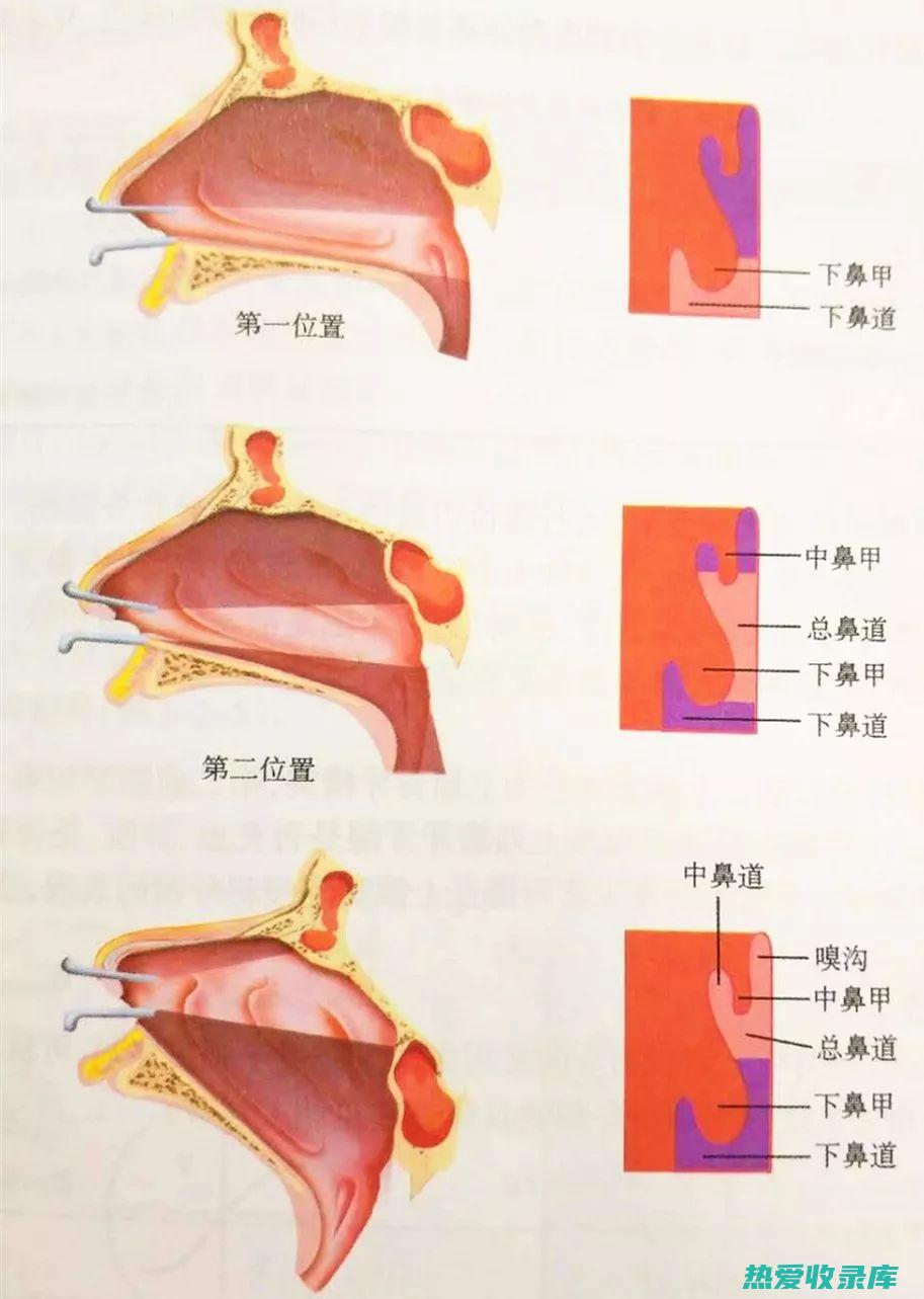 过敏性鼻炎中药方剂 (过敏性鼻炎中药配方)