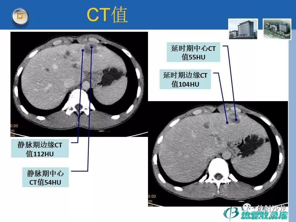 胁肋疼痛(胁肋疼痛什么原因)