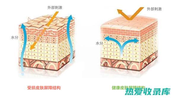 皮肤反应，如皮疹或荨麻疹(皮肤反应是什么意思)