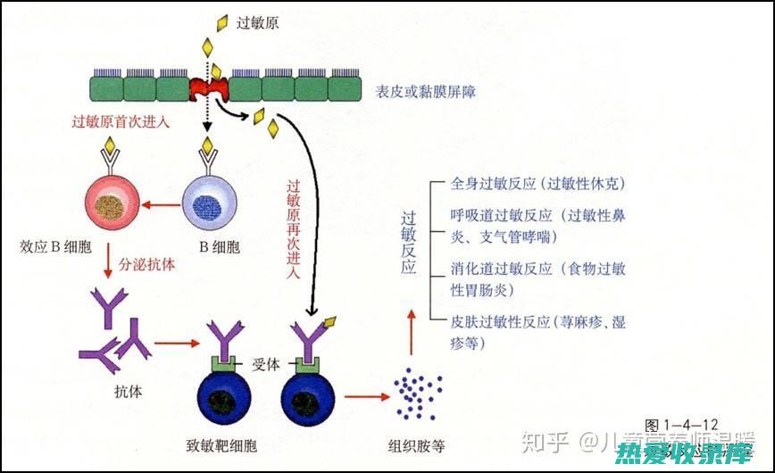 过敏性湿疹的中药治疗