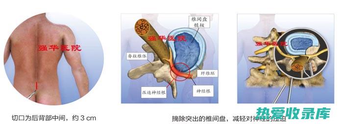 手术（包括核心减压和髋关节置换）(手术核查的时机分别是在?)