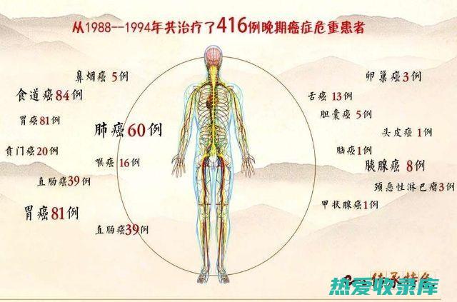 中医癌症治疗药方：古老智慧对抗现代疾病 (中医癌症治疗的最新方法)