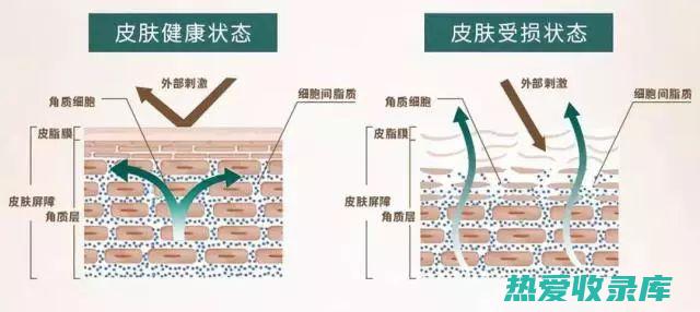 皮肤屏障受损 (皮肤屏障受损怎么修复)