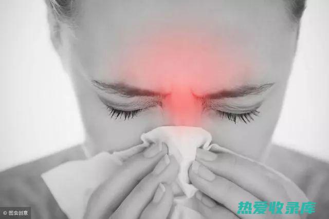 鼻炎：过敏性鼻炎、慢性鼻炎等(鼻炎过敏性鼻炎用什么药)