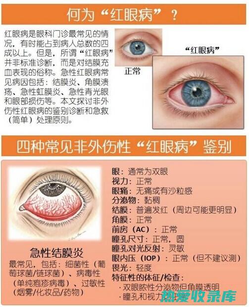 如果红眼痛症状较严重或持续不愈，应及时就医。(红眼痛症状)