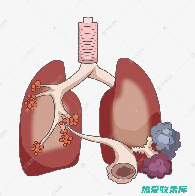 慢性阻塞性肺疾病 (COPD)(慢性阻塞性肺病的症状和治疗方法)